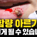 아르기닌 입술 헤르페스 부작용 이걸 드시면 깔끔하게 해결됩니다(아르기닌 부작용에 대한 진실과 라이신의 효능) 이미지