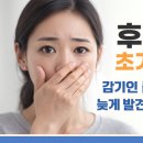 후두암 초기증상, 감기인 줄 알았다가 늦게 발견되는 이유