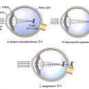 밝은아이안경 이미지
