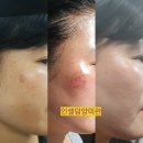 은하 인셀덤 | 인셀덤 화장품 인셀덤 사업 인셀덤 서울본부 인셀덤 부작용 인셀덤 찐 리얼후기!!