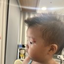 한강수성형외과의원 | 아기 얼굴 상처, 눈 찢어짐으로 봉합수술@체리성형외과의원