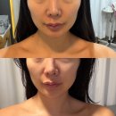 진여요 | 압구정 진여워터테라피 솔직후기
