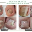 큐릭스 이미지