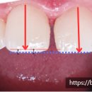 채움치과기공소 이미지