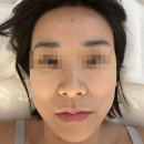피오닉에스테틱 | 서현역 에스테틱, 모공관리 '피오닉에스테틱' 피부관리 후기!