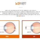 굿피플 안경원 이미지