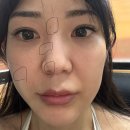 생기쑥뜸힐링카페 | 알고리즘이 이끈 쑥찜질 카페 후기! 먹골역 황제쑥뜸에서 개운하게 땀 빼고 관상까지 보고 온 썰