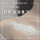 멍클린 | 결혼 전 타투제거후기｜신논현 클린타투의원 레터링 타투제거 2회차