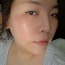 백석동 피부관리 모공케어 연예인피부관리 르베라 천안점 (구.밍언니) 메디레티필 2주후기
