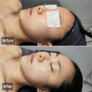[영통역 피부관리] 슬기로운 에스테틱 스킨부스터 후기