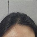 헤어엘(el) | 가려움 샴푸추천 탈모샴푸 퍼리키 실크실드 글로우 샴푸 엘 EL 솔직후기