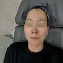 더설레임피부과의원 | 영종도피부과 추천, 리베리의원 포텐자 쥬베룩 내돈내산 솔직후기