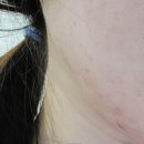 별고운빛의원 이미지