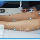 이슬왁싱