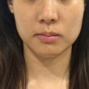 오앤리 스킨엔헤드스파 파주점 이미지