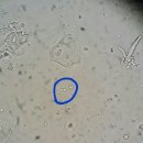 yeast, hyphae 보여서 사진 찍어봤어요..^^ 이미지