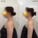 부천바디관리 무니크에어바디 상체균형관리 1회만으로도 효과 보장