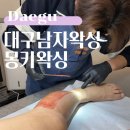 몽키왁싱 대구 남자왁싱 | 대구남자왁싱, 몽키왁싱 두 번째 방문 후기