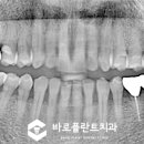오늘바로플란트치과의원 이미지