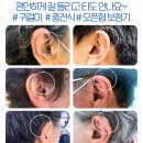 (주)바른보청기히어링케어 | 강동구보청기 바른보청기 히어링케어