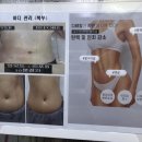 브니엘 헤어 이미지