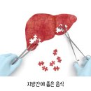 지방간에 좋은 음식 이미지