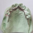 프레임치과기공소 이미지