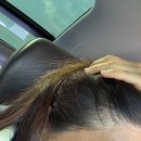 정영선미용실 | [로아르스칼프 SMP] 내돈내산 헤어라인 고민이면 무조건 가주라 주