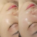 A1335 | [설레임 에스테틱] : 부산 다대포 피부관리샵 왕추천 / 얼굴 광내고 온 솔직 후기!