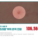 올리브영 세럼, 메디힐 마데카소사이드 흔적 리페어 세럼 [더블 기획 토이스토리 에디션]