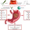 Re: Autoimmune Atrophic Gastritis: A Clinical Review 2024 이미지