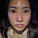 둔산중로-40 | 대전 둔산동 신부관리 웨딩관리 후기, 아로뮤에스테틱 (+뮤프팅 후기, 주차정보)