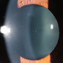 서창밝은안과의원 이미지