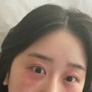 코코아이성형외과의원 | 강남 신사 리아이성형외과 쌍커풀 재수술 눈 재수술 상담 (눈 전문 병원, 주차, 상담비)