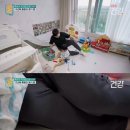 30대 통풍 환자의 발 상태 ㄷㄷㄷㄷㄷ 이미지