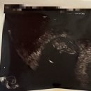 좋은날에 드라마여성병원 | [임신 6주-10주]좋은날에 드라마여성병원 9과, 초음파 검사, 갑상선 수치검사, 조리원 예약후기