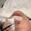 고고 | 블랙헤드전문 건대 고고뷰티 찐만족 후기