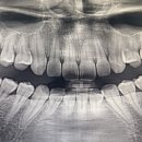 서울럭스치과의원 이미지