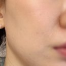 스킨트리 | 다이소 여행용 스킨케어 추천. 이즈앤트리 어니언 블레미쉬 가성비템 솔직 후기