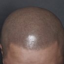 에디뷰티 이미지