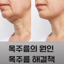 가로세로 | 세로, 가로목주름을 해결한 목거상술 후기가 궁금하다면