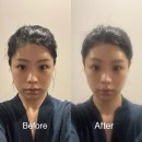 안면하우스 | 강남 신부관리 ‘뷰티블르바드 청담’ 안면축소윤곽관리 후기