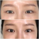 밀라뷰티 대구본점 이미지