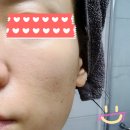 피부관리 :) 충주 와이에스에스테틱 관리 내돈내산 솔직 후기