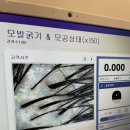 인디자인 | 포항 죽도동 두피관리 잘하는 인디자인탈모센터 후기