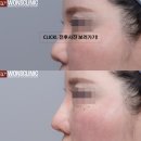 하이코코 이미지