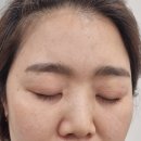 안도영뷰티 | 치위생사의 일기-페이스왁싱