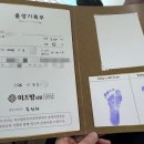 신생아 BCG 불주사접종과 설소대 제거와 딤플 초음파 후기