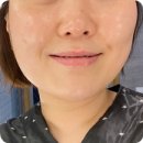 씨제이올리브영(주) 서면가야대로점 | 부산피부관리 서면아쿠아필 2회차 후기