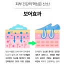 본코리아 '엔젤 클렌징 파우더 효소 세안제' 사용 후기, 사춘기 여드름 세안제